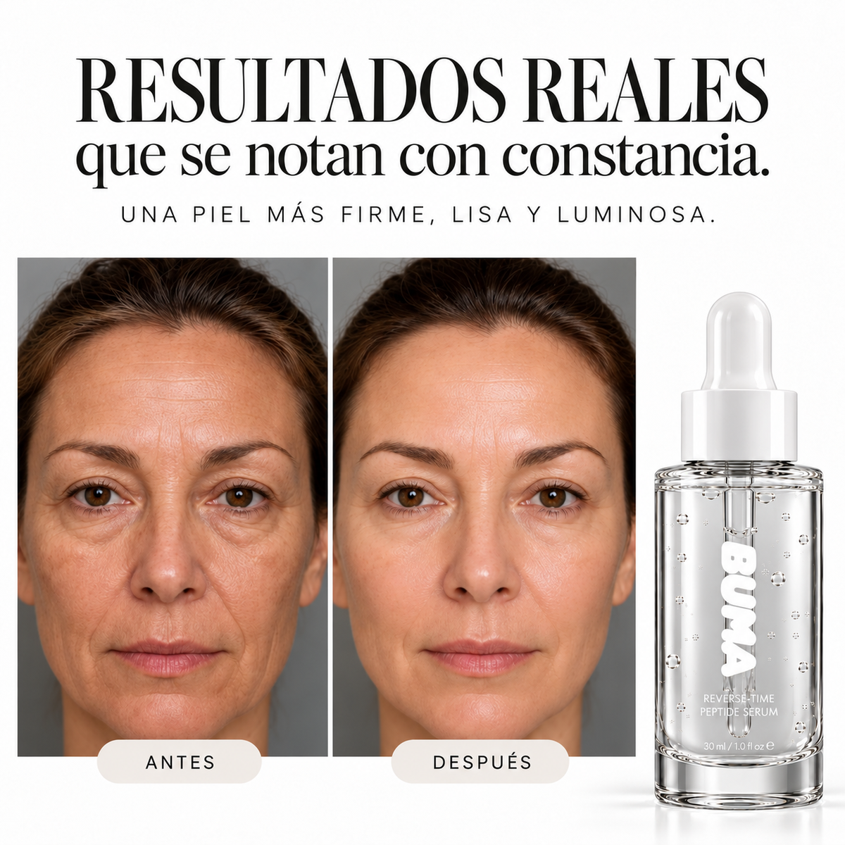 BUMA® - Serum Anti-Age con PDRN + Péptidos. El tratamiento coreano de firmeza, sin agujas.